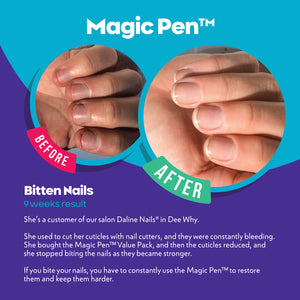 Magic Pen Repair and Growth - Nail Cream - Contains Argan oil and Vitamin E - Vegan and Made in Australia - Bitten nails Never more